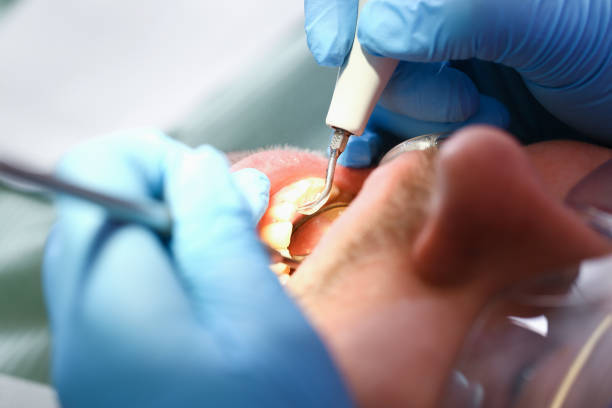 Best Urgent Tooth Repair  in Inglis, FL