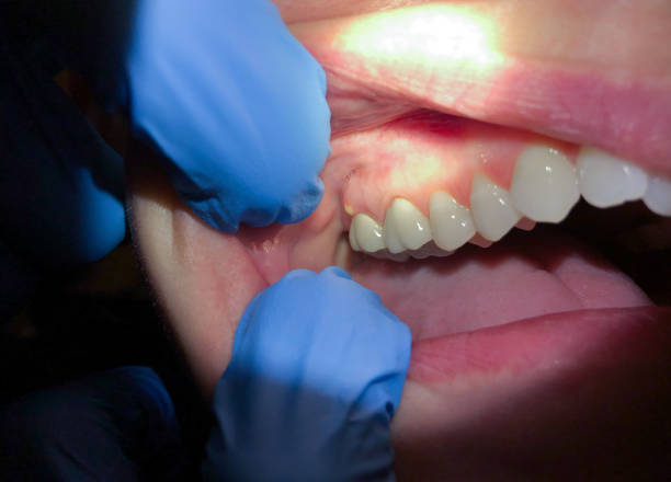 Best Emergency Tooth Extraction  in Inglis, FL